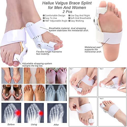 Foot Care Toe Bunion Splint Corrector Orthopedic Braces