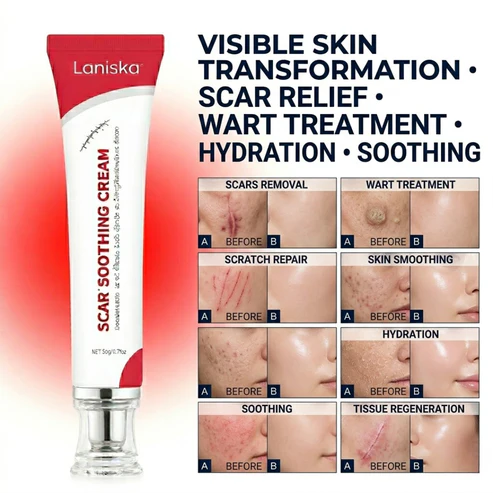 Laniska Scar Soothing Cream | 7-in-1 Skin Repair with Argan Oil, Shea Butter, Vitamin E & Hyaluronic Acid | Fades Scars, Warts & Scratches, Deep Hydration - Image 6